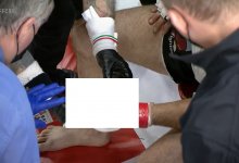 Khetag Pliev verliest vinger tijdens CFFC 94 evenement (Geen 1 april grap)